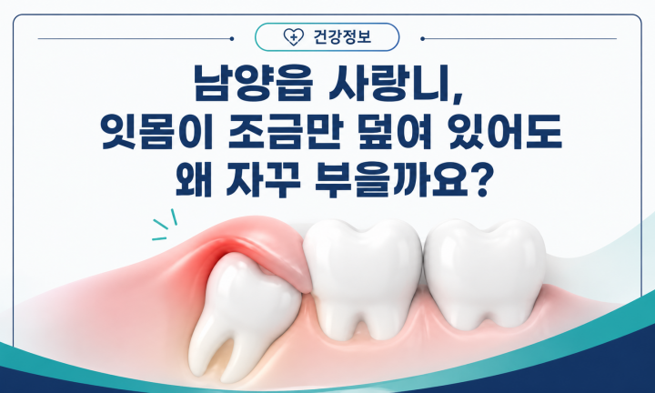 남양읍 사랑니 주변을 잇몸이 일부 덮고 있는 모습