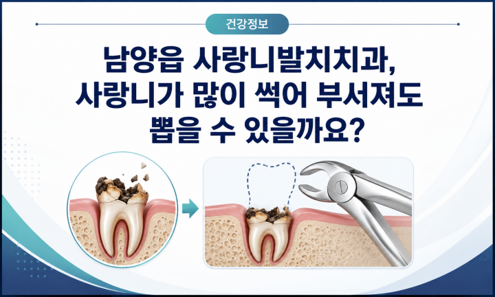 심하게 썩어 치아 머리가 부서지고 뿌리가 남아 있는 사랑니