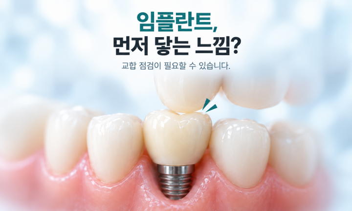 남양읍 임플란트 치과 보철물이 먼저 닿는 느낌과 치아 맞물림 점검