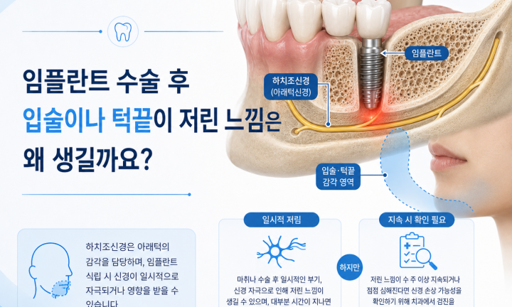 아래턱 임플란트와 하치조신경 및 턱끝 감각신경의 위치를 설명하는 이미지