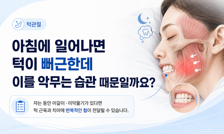 자는 동안 이갈이와 이악물기로 턱 근육이 긴장되는 모습을 설명하는 이미지