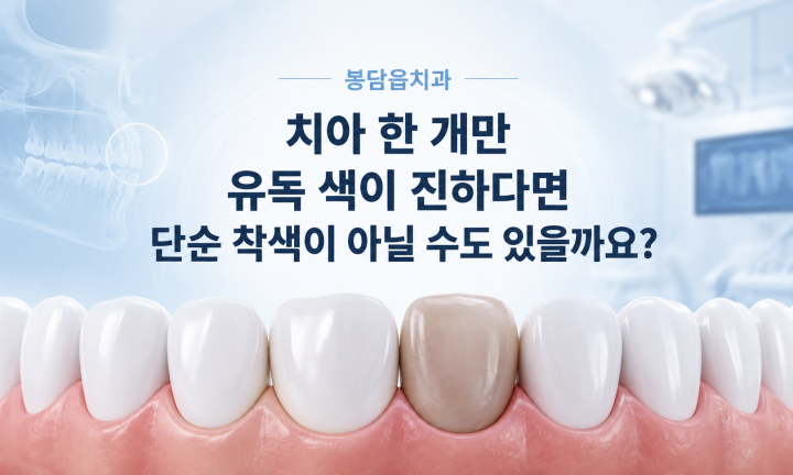 치아 한 개만 어두워졌을 때 외상과 신경 상태를 확인하는 치과 진료 안내